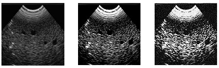 解析相機(jī)相關(guān)參數(shù)的設(shè)置-機(jī)器視覺(jué)_視覺(jué)檢測(cè)設(shè)備_3D視覺(jué)_缺陷檢測(cè)