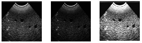 解析相機(jī)相關(guān)參數(shù)的設(shè)置-機(jī)器視覺(jué)_視覺(jué)檢測(cè)設(shè)備_3D視覺(jué)_缺陷檢測(cè)