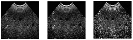 解析相機(jī)相關(guān)參數(shù)的設(shè)置-機(jī)器視覺(jué)_視覺(jué)檢測(cè)設(shè)備_3D視覺(jué)_缺陷檢測(cè)