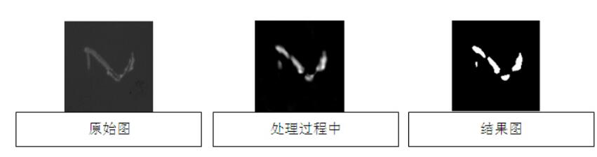 液晶屏幕視覺檢測，液晶屏幕劃痕污點缺陷檢測方案-機器視覺_視覺檢測設(shè)備_3D視覺_缺陷檢測